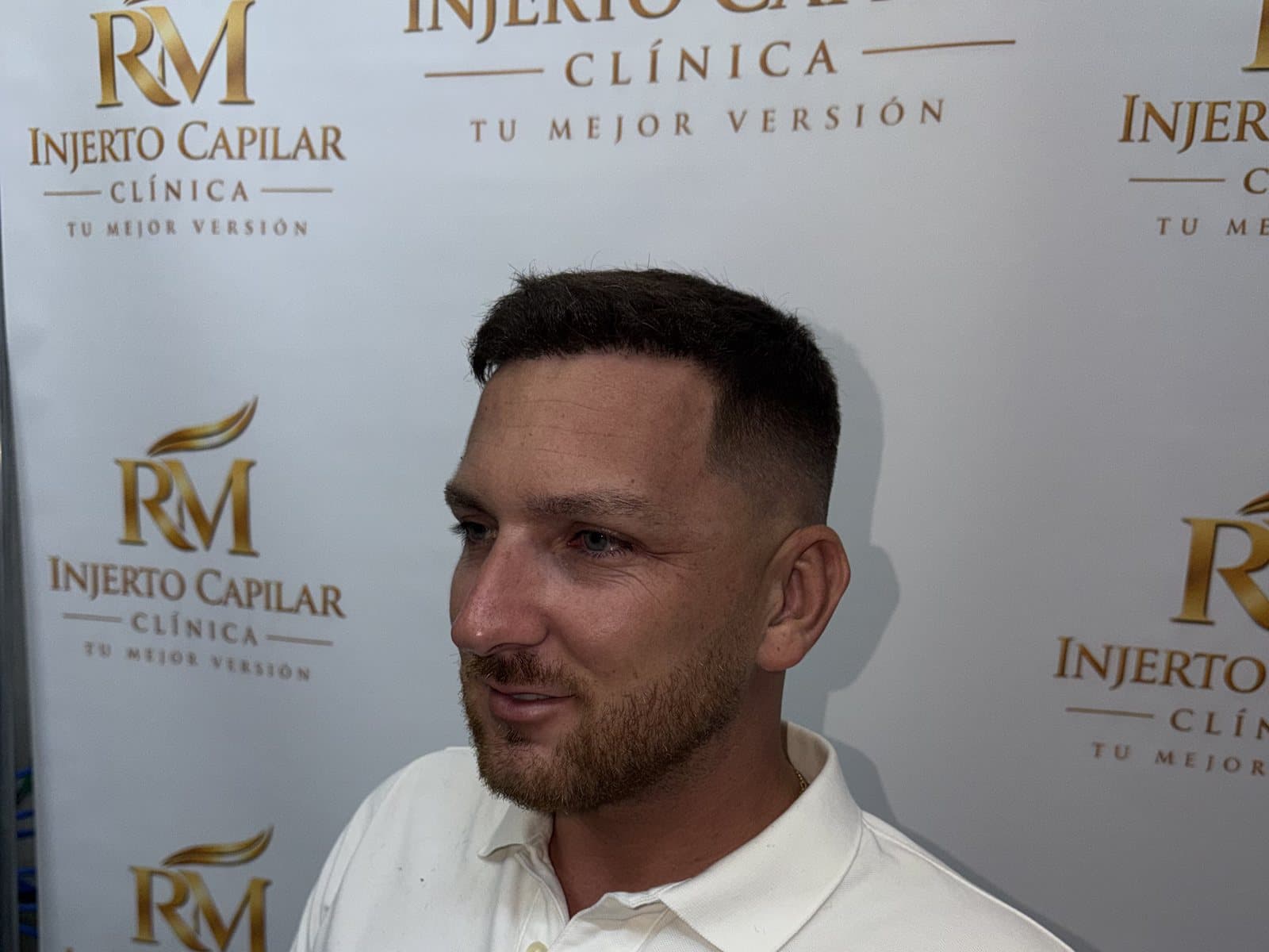 Paciente de RM Injerto Capilar sentado delante del photocall de la clínica en Tomares