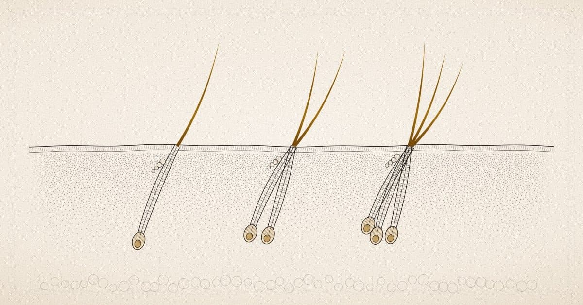 Ilustración de unidades foliculares de uno, dos y tres pelos