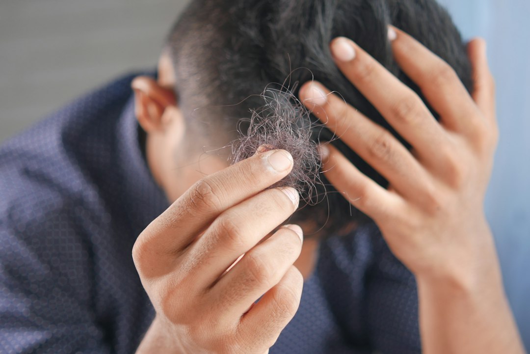 Se me cae el pelo a puñados: ¿es caída estacional o el principio de una alopecia?