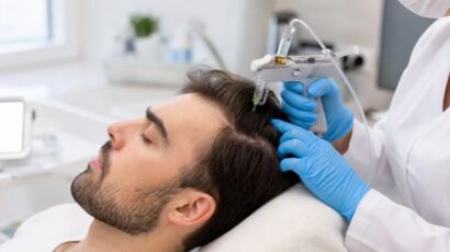 Mesoterapia capilar en Sevilla - sesión de tratamiento en RM Injerto Capilar